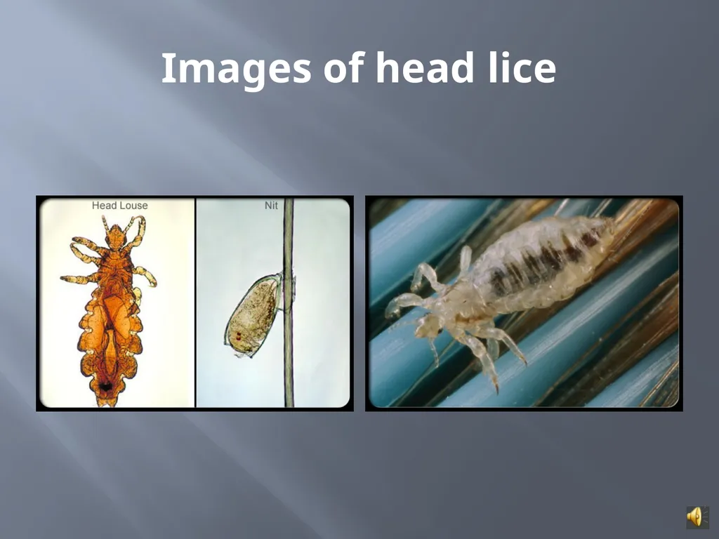 MANAGING HEAD LICE IN THE SCHOOL SETTING A - slide 8 of 22