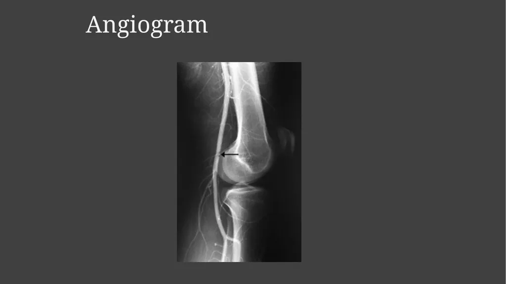 Contrast Radiography Dr. Gulshan Kumar MVSc, PhD - slide 29 of 30