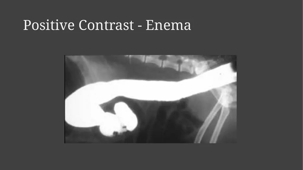 Contrast Radiography Dr. Gulshan Kumar MVSc, PhD - slide 18 of 30