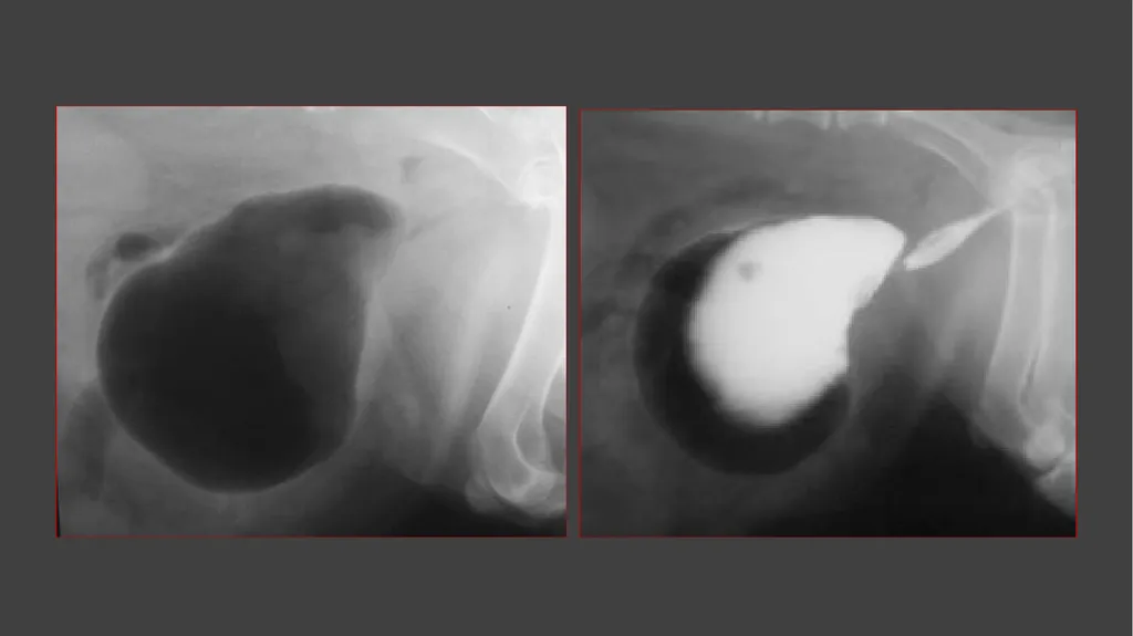Contrast Radiography Dr. Gulshan Kumar MVSc, PhD - slide 22 of 30