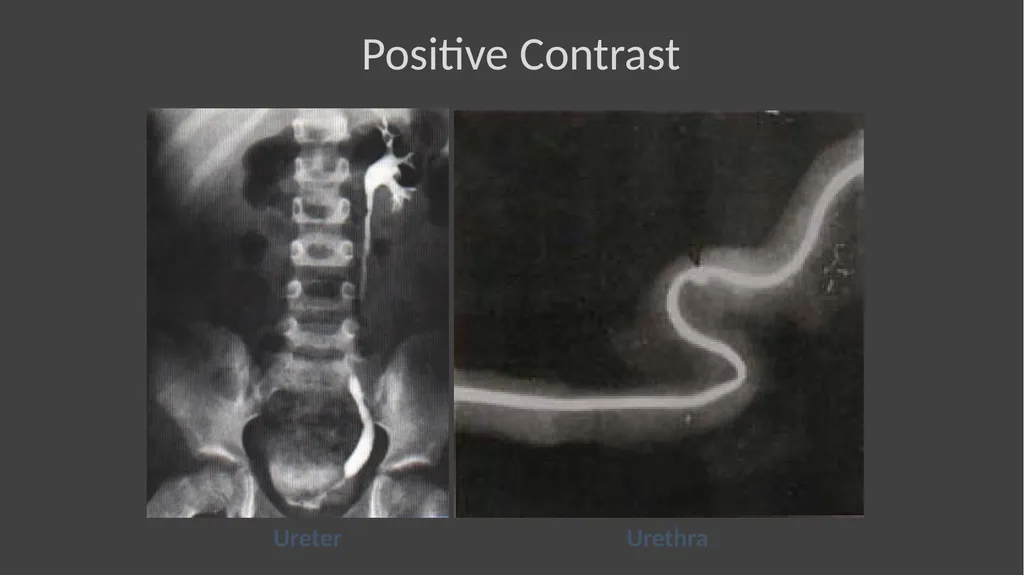 Contrast Radiography Dr. Gulshan Kumar MVSc, PhD - slide 20 of 30