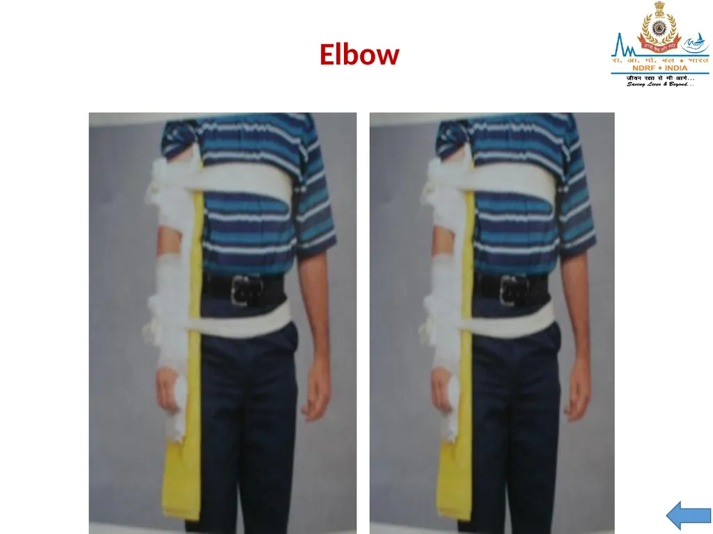 MUSCULOSKELETAL INJURIES LESSON -20 BY JITENDER - slide 56 of 58