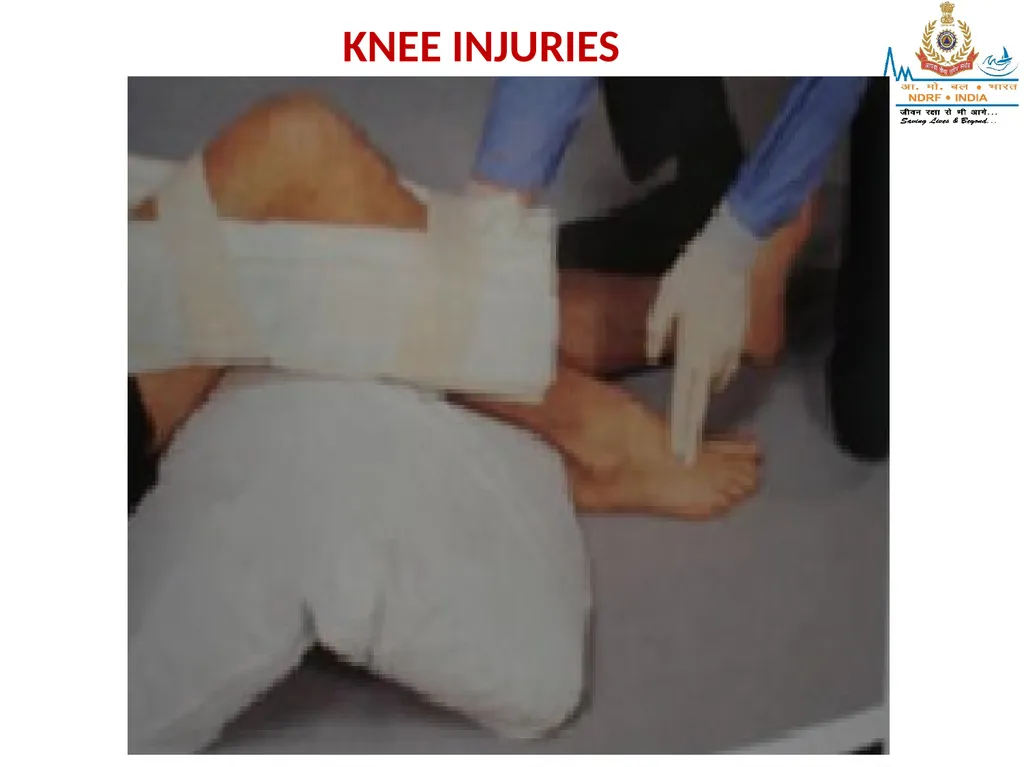 MUSCULOSKELETAL INJURIES LESSON -20 BY JITENDER - slide 43 of 58