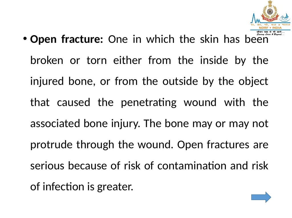 MUSCULOSKELETAL INJURIES LESSON -20 BY JITENDER - slide 7 of 58