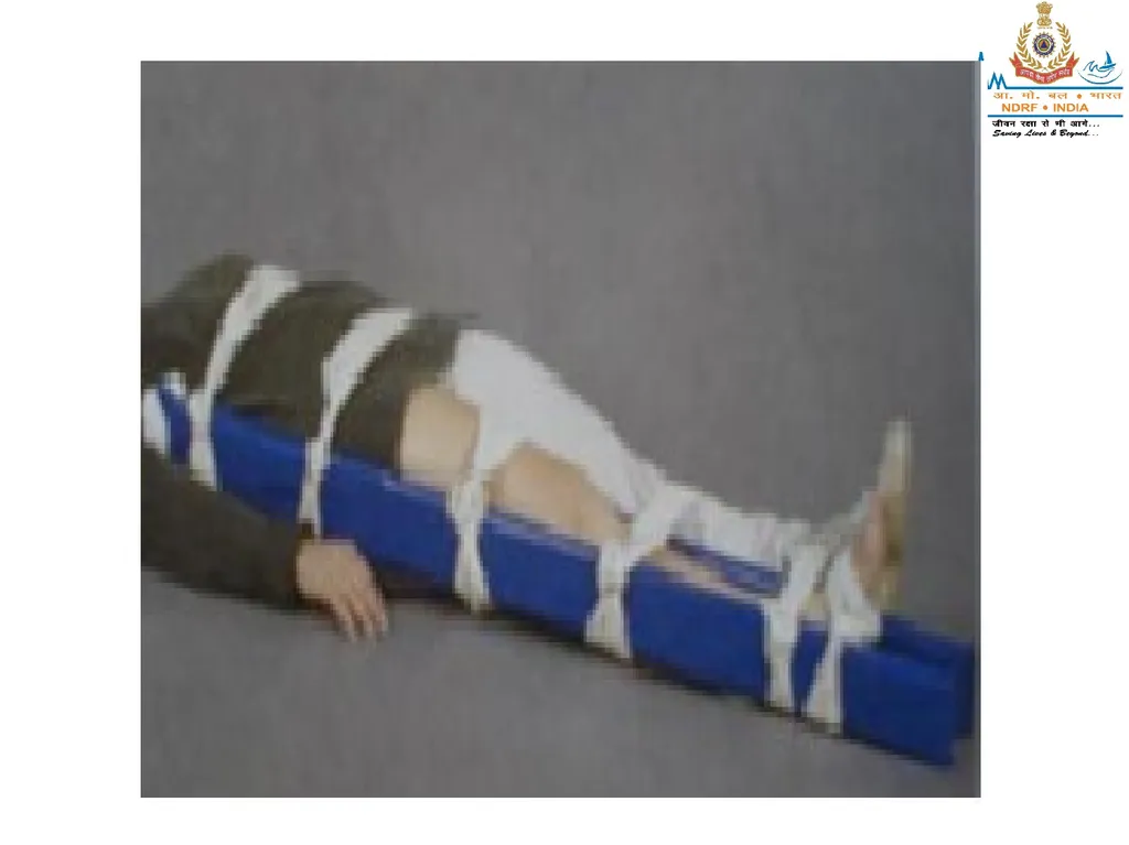 MUSCULOSKELETAL INJURIES LESSON -20 BY JITENDER - slide 37 of 58