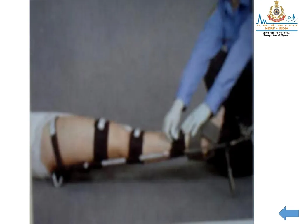 MUSCULOSKELETAL INJURIES LESSON -20 BY JITENDER - slide 53 of 58