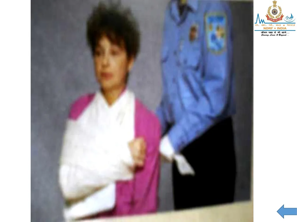 MUSCULOSKELETAL INJURIES LESSON -20 BY JITENDER - slide 54 of 58