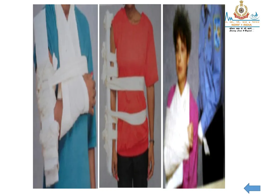 MUSCULOSKELETAL INJURIES LESSON -20 BY JITENDER - slide 55 of 58