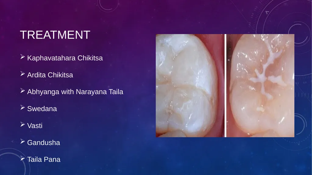 Dental Disorders in Ayurveda Danta Rogas Ayurveda - slide 12 of 28