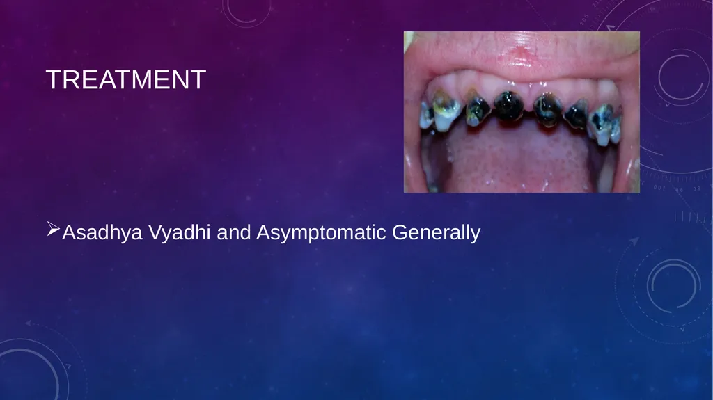 Dental Disorders in Ayurveda Danta Rogas Ayurveda - slide 20 of 28