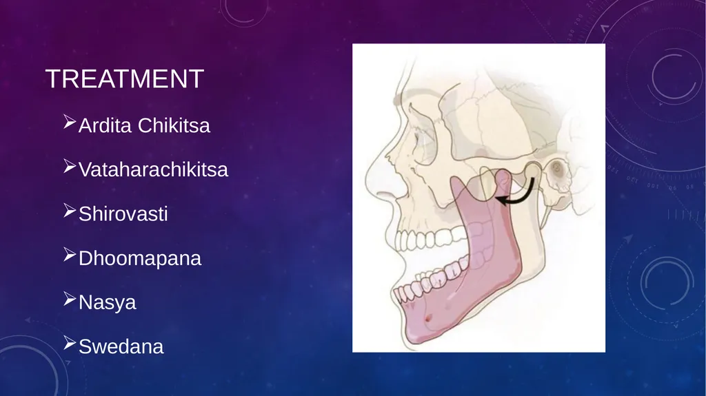 Dental Disorders in Ayurveda Danta Rogas Ayurveda - slide 22 of 28