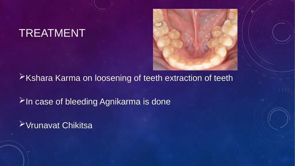 Dental Disorders in Ayurveda Danta Rogas Ayurveda - slide 27 of 28