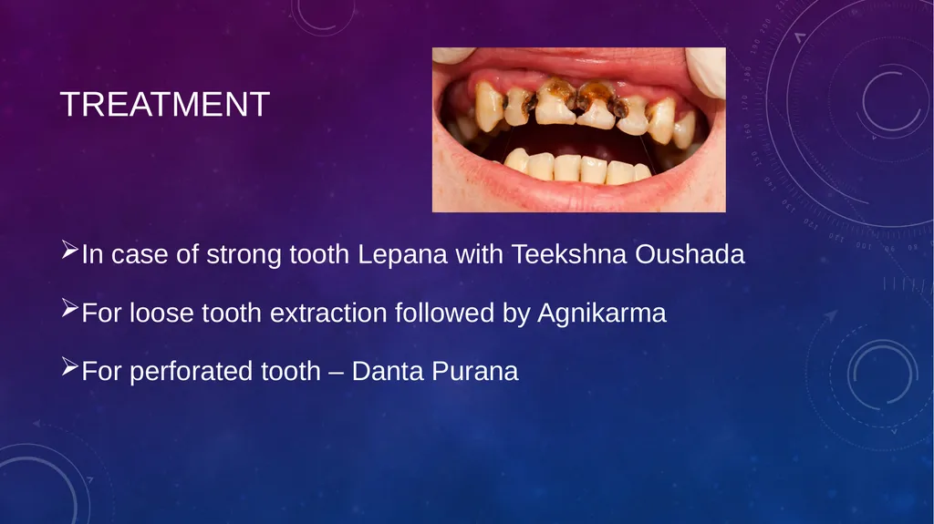 Dental Disorders in Ayurveda Danta Rogas Ayurveda - slide 7 of 28
