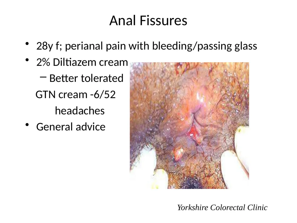 Everything there is to know about colorectal - slide 45 of 73