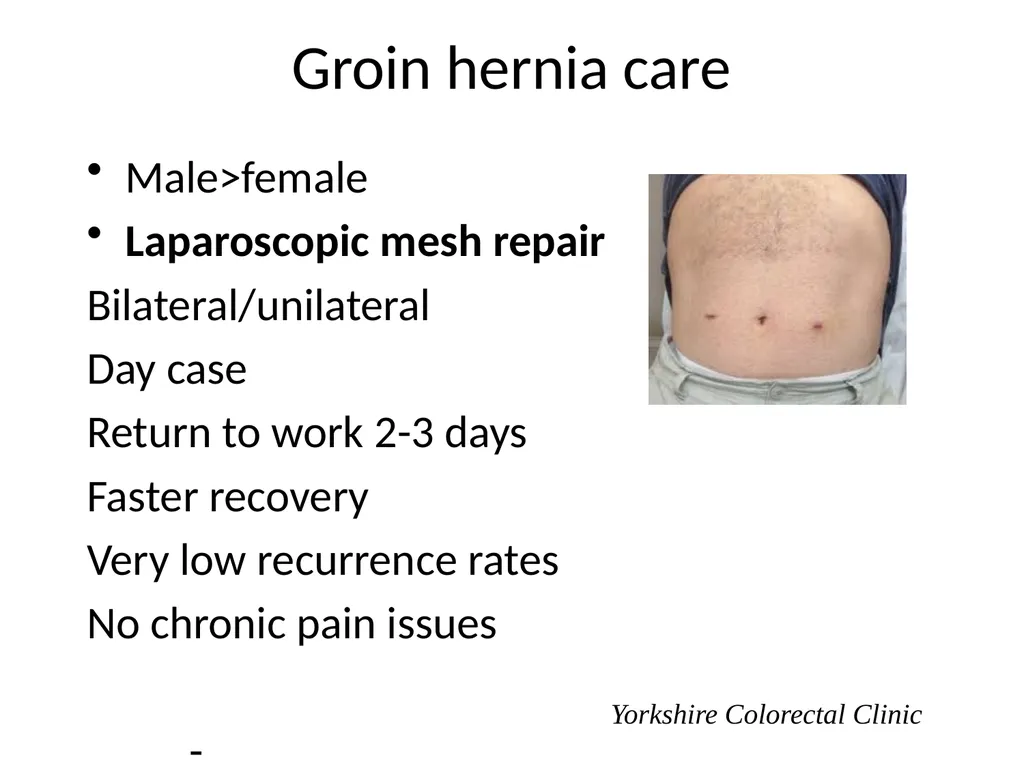 Everything there is to know about colorectal - slide 62 of 73