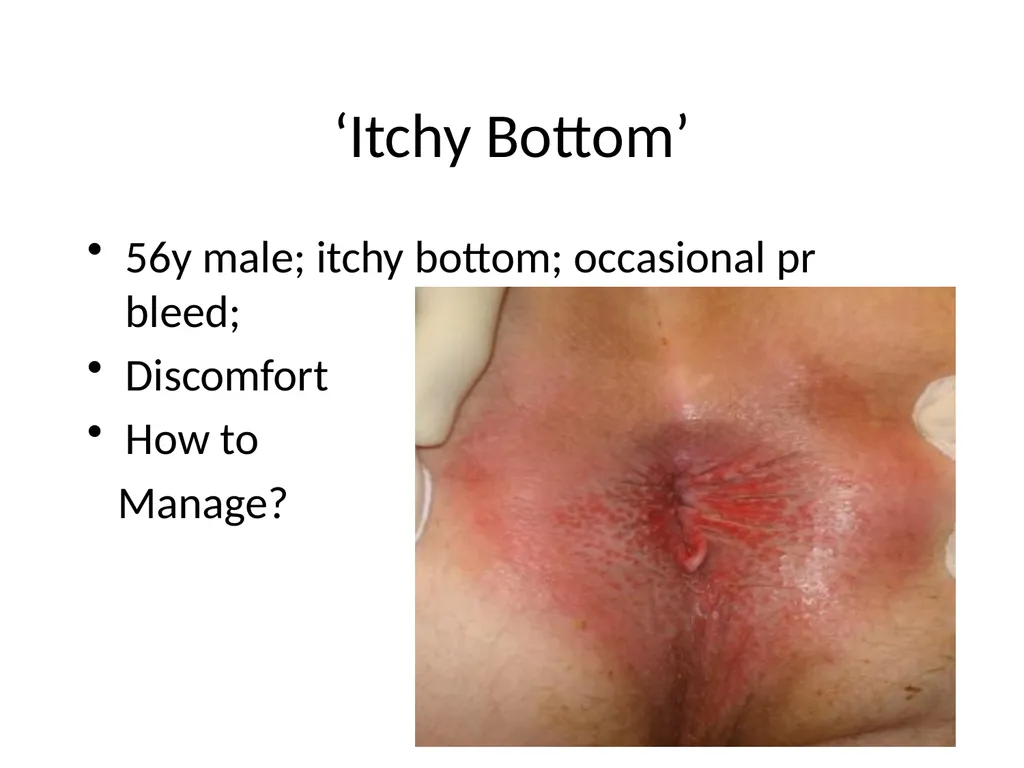 Everything there is to know about colorectal - slide 47 of 73