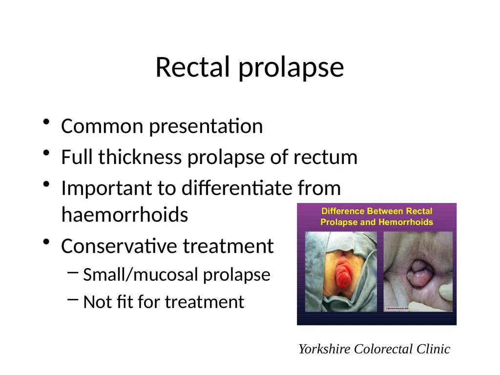 Everything there is to know about colorectal - slide 59 of 73