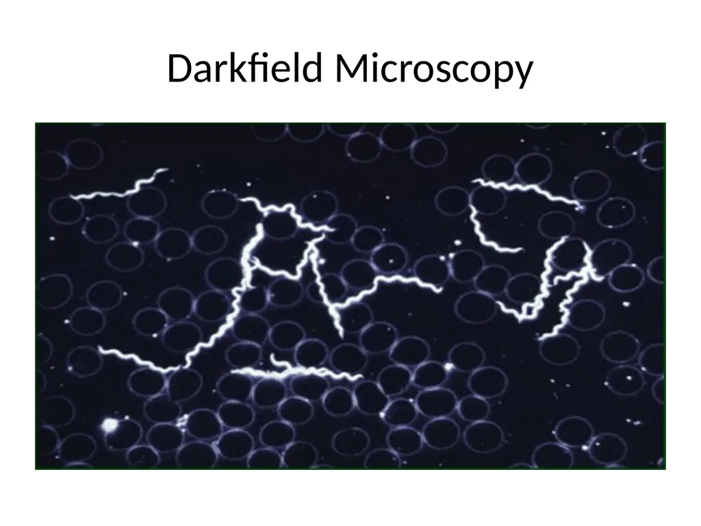 Main pathogenic bacteria of Spirochetaceae - slide 5 of 14