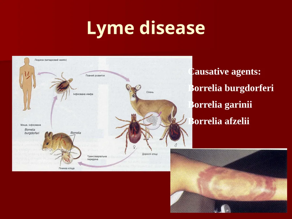 Main pathogenic bacteria of Spirochetaceae - slide 12 of 14