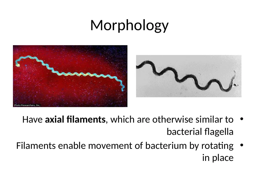 Main pathogenic bacteria of Spirochetaceae - slide 4 of 14