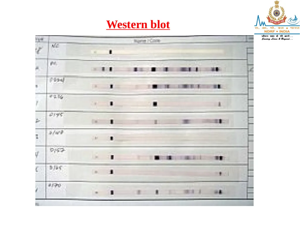SEROLOGY LESSON -11 By OMKAR YADAV INSP/PH Upon - slide 21 of 43