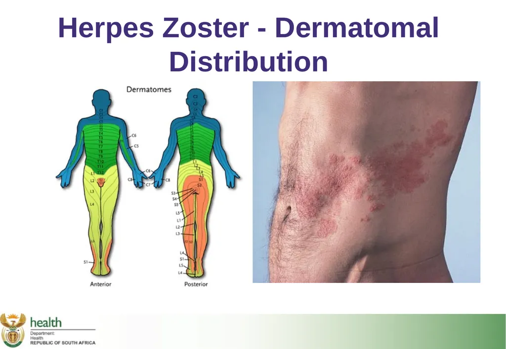 Basic HIV Course for Health Professionals Session - slide 9 of 59