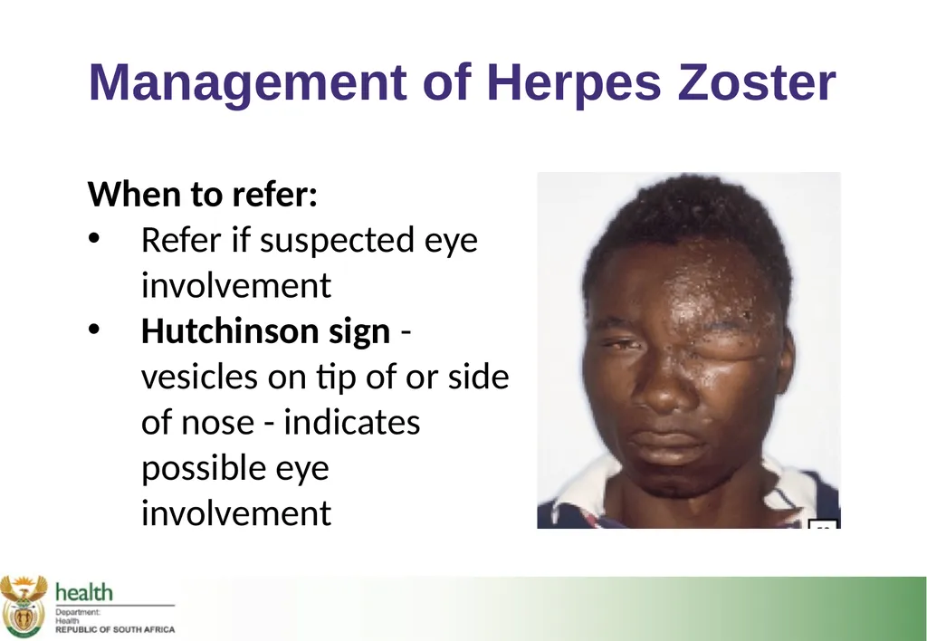 Basic HIV Course for Health Professionals Session - slide 12 of 59