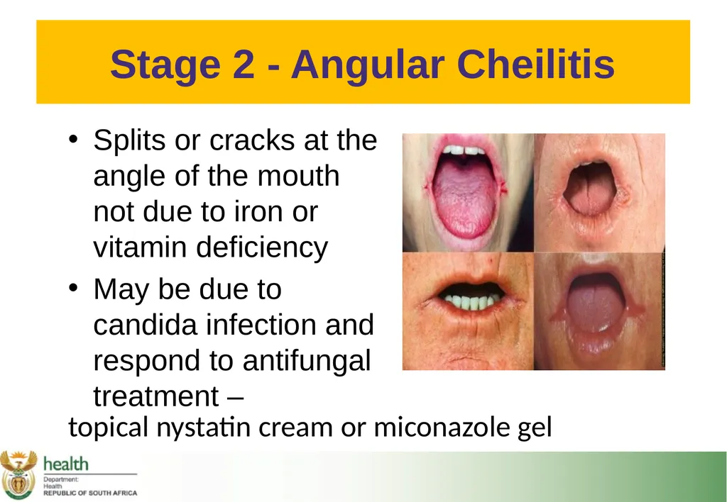 Basic HIV Course for Health Professionals Session - slide 14 of 59