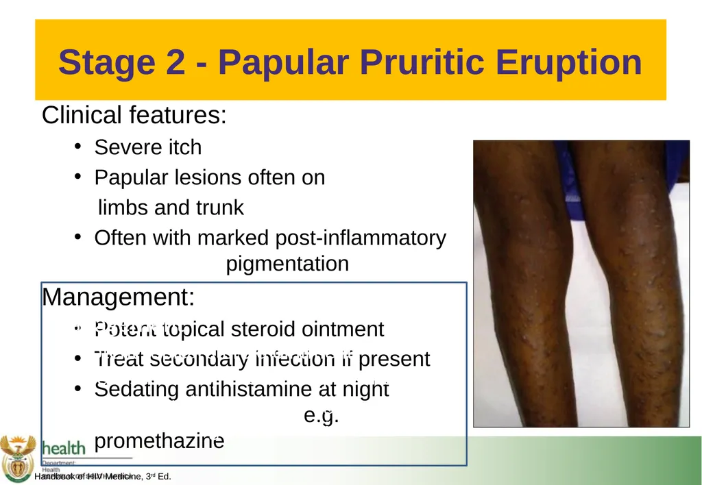 Basic HIV Course for Health Professionals Session - slide 13 of 59