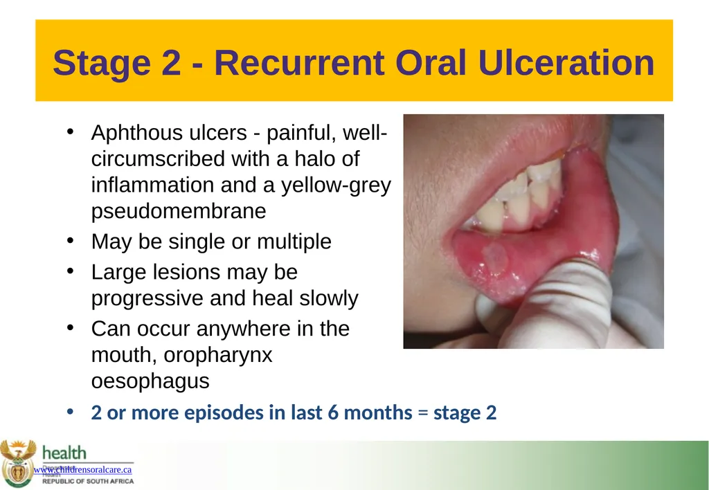 Basic HIV Course for Health Professionals Session - slide 18 of 59