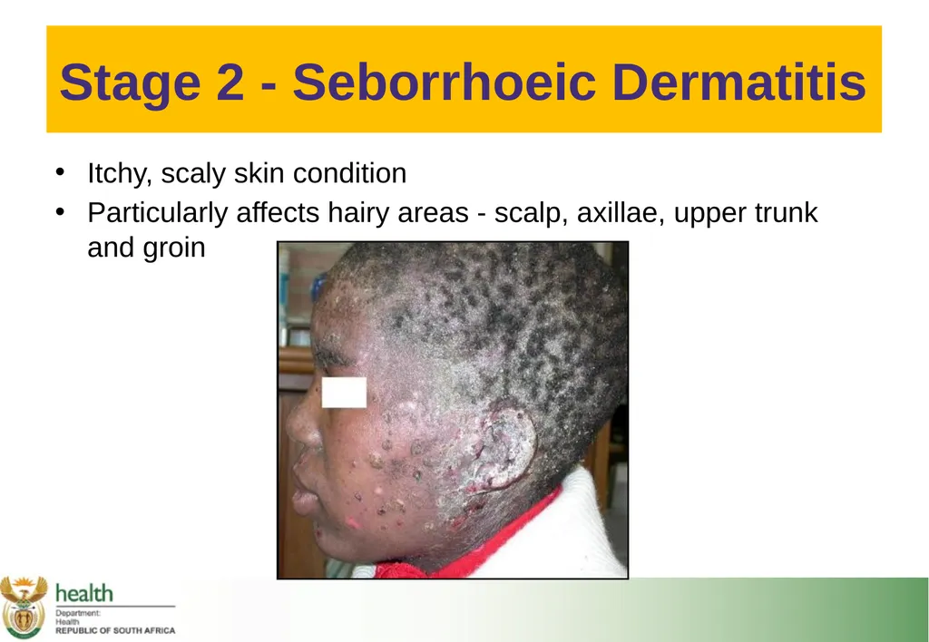 Basic HIV Course for Health Professionals Session - slide 15 of 59