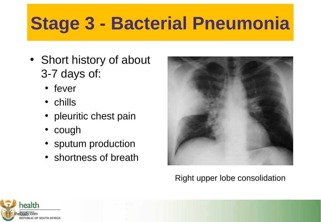 Basic HIV Course for Health Professionals Session - slide 30 of 59
