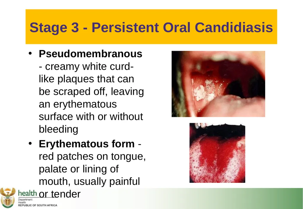 Basic HIV Course for Health Professionals Session - slide 24 of 59