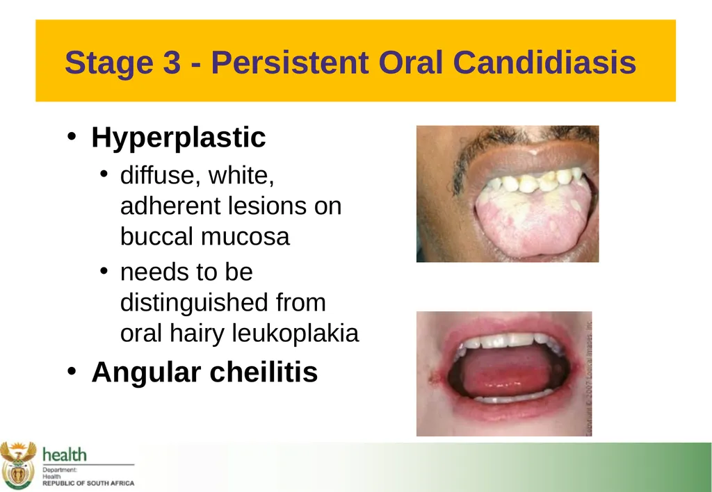 Basic HIV Course for Health Professionals Session - slide 25 of 59