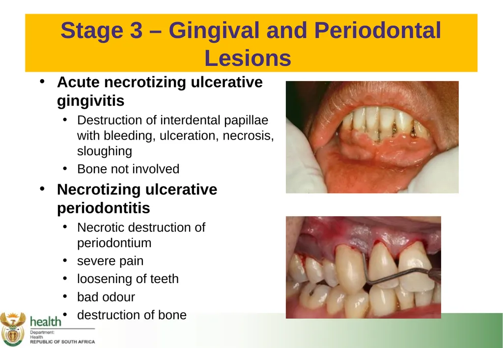 Basic HIV Course for Health Professionals Session - slide 33 of 59