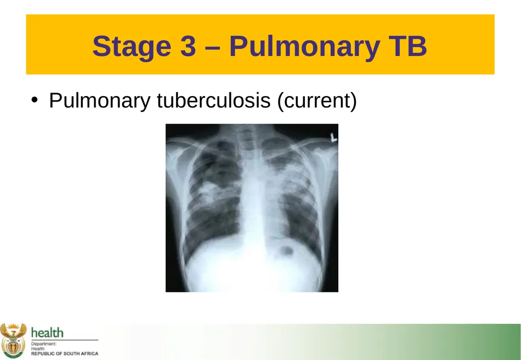 Basic HIV Course for Health Professionals Session - slide 31 of 59