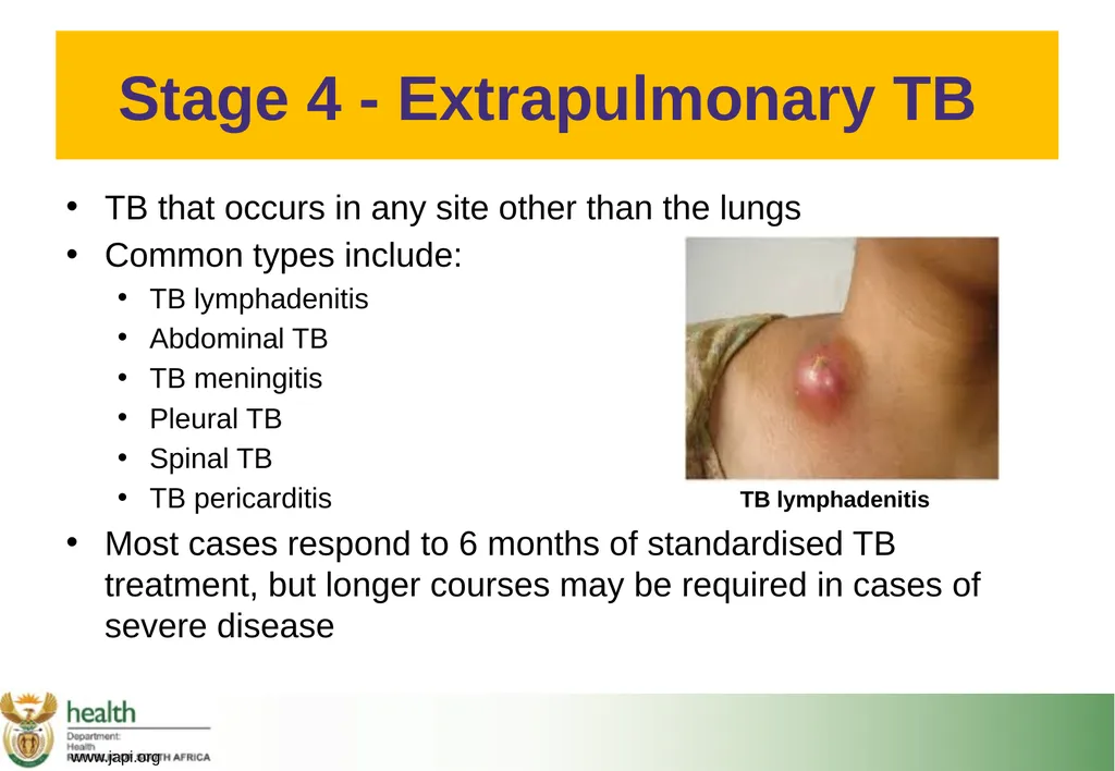 Basic HIV Course for Health Professionals Session - slide 47 of 59