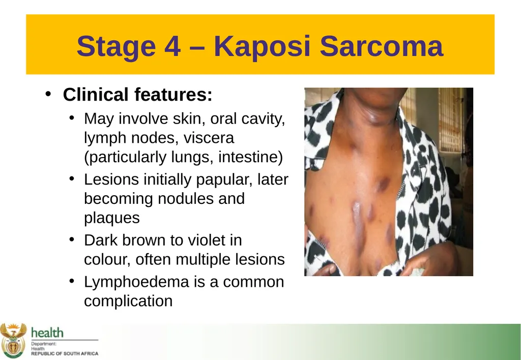 Basic HIV Course for Health Professionals Session - slide 48 of 59