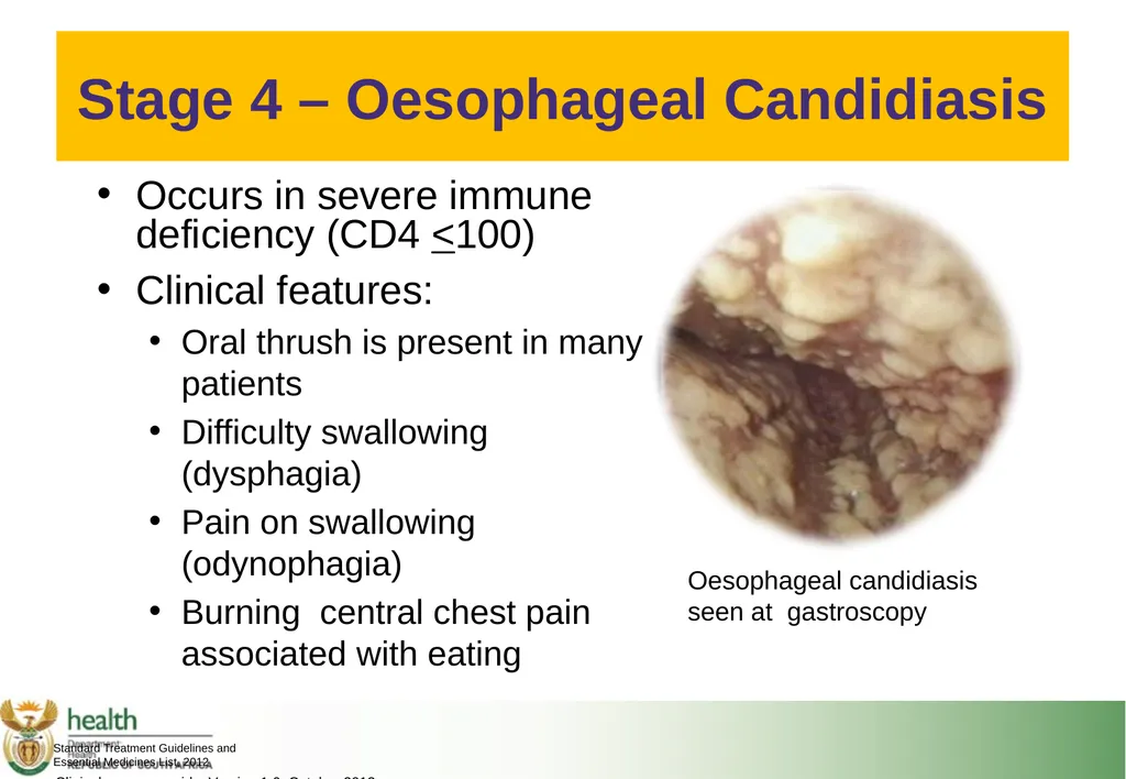 Basic HIV Course for Health Professionals Session - slide 45 of 59