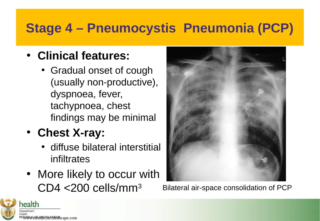 Basic HIV Course for Health Professionals Session - slide 53 of 59