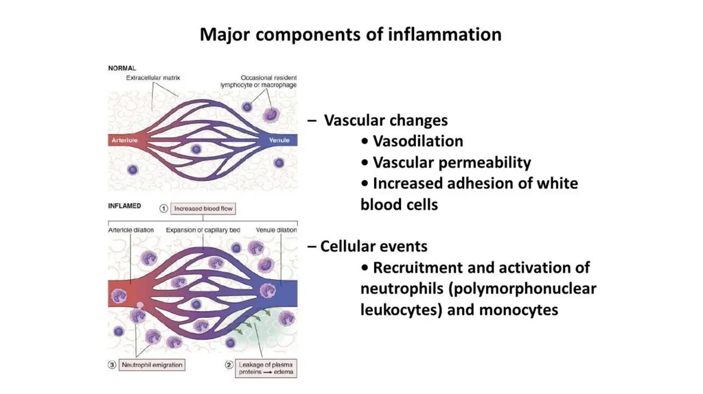 Inflammation Inflammation is a protective response - slide 5 of 15