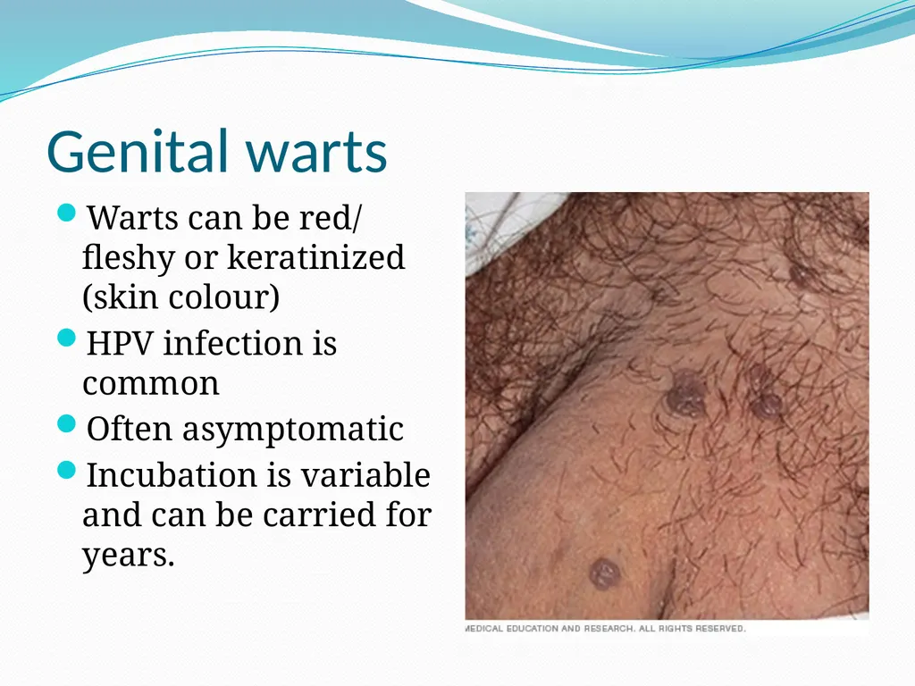 CLOSING THE GAP Module 3a 2018 Recap CTG modules - slide 29 of 58