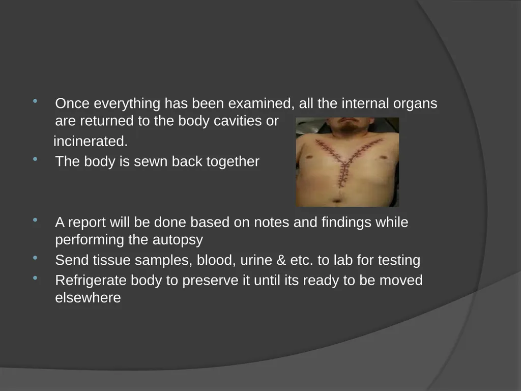 AUTOPSIES Autopsy; also called necropsy, - slide 17 of 21