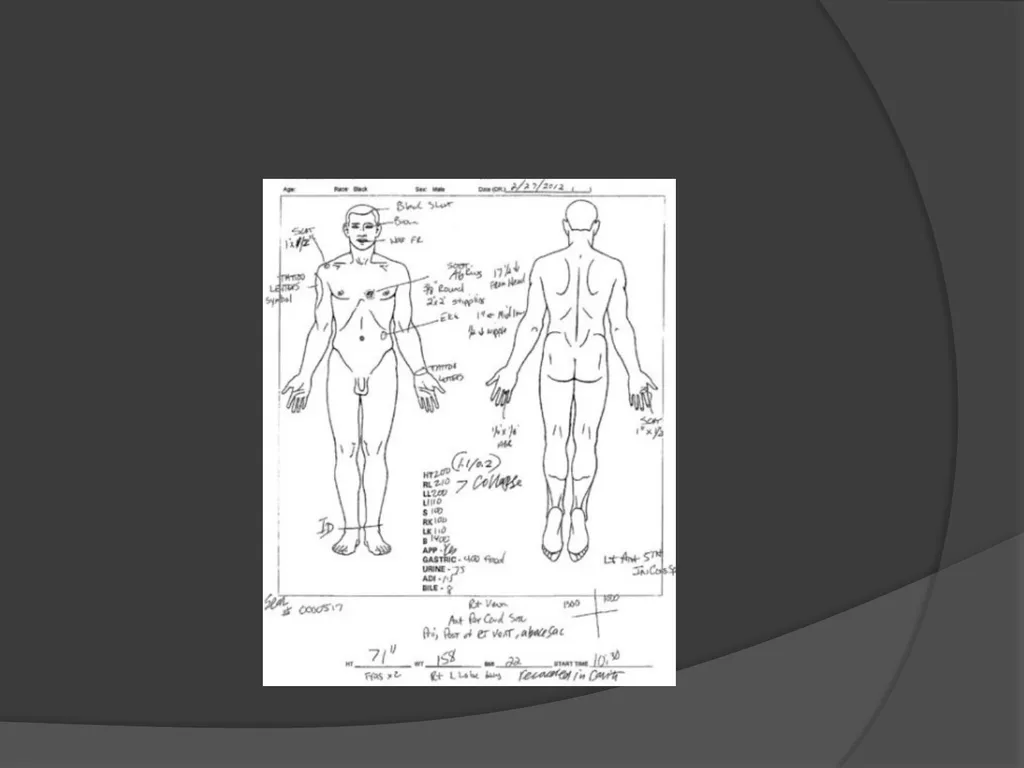 AUTOPSIES Autopsy; also called necropsy, - slide 11 of 21