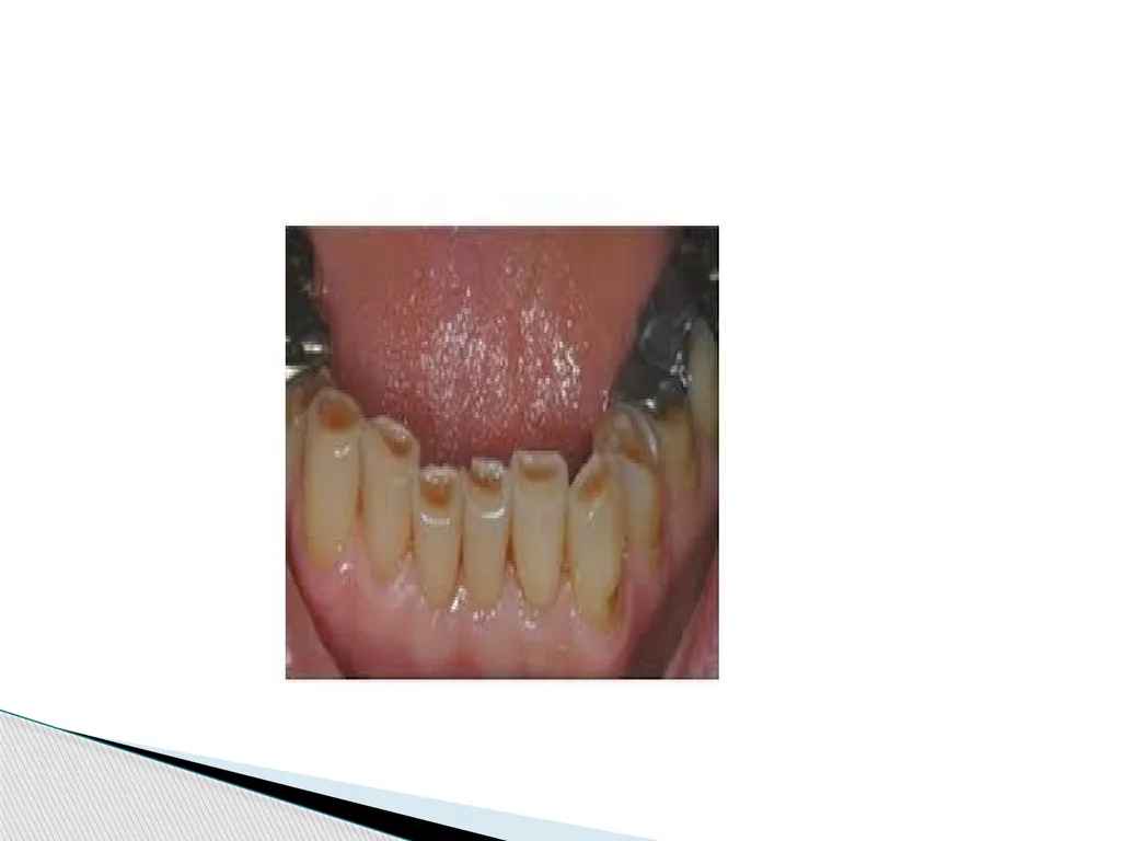 AMELOGENESIS According to their function, the life - slide 38 of 48
