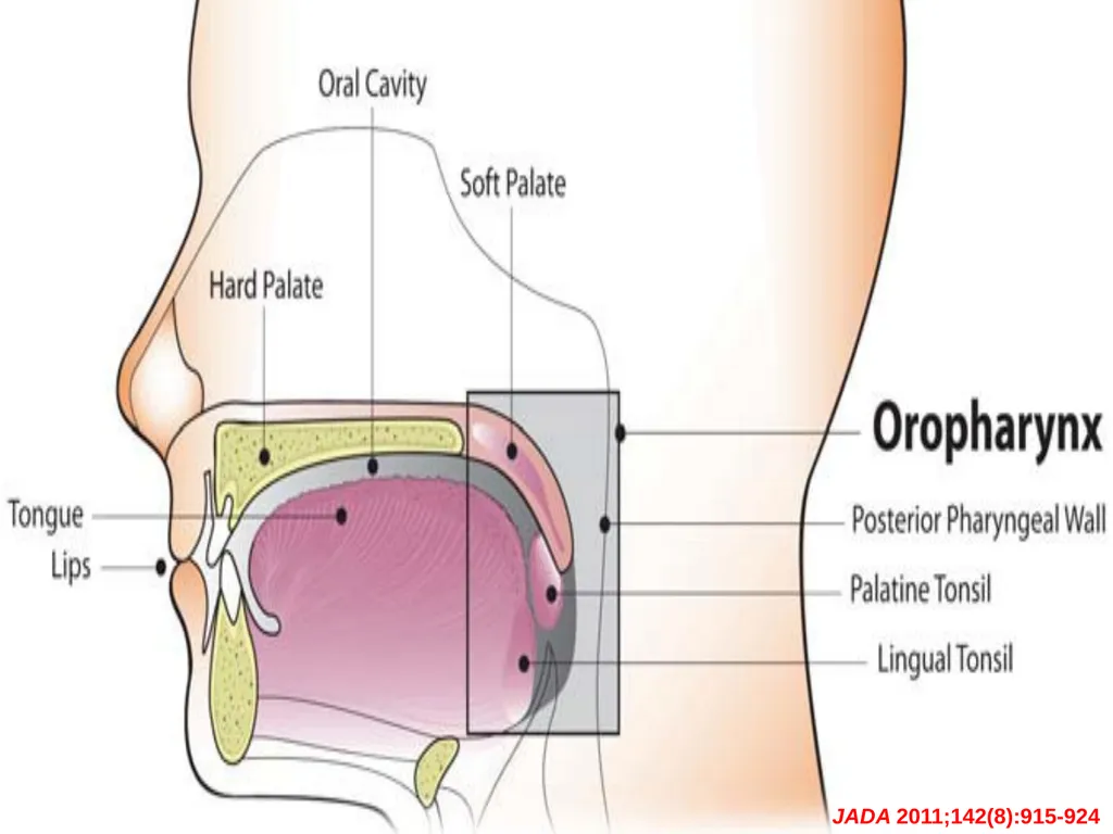 HPV & Oropharyngeal Cancer Mahnaz Fatahzadeh, DMD - slide 4 of 20