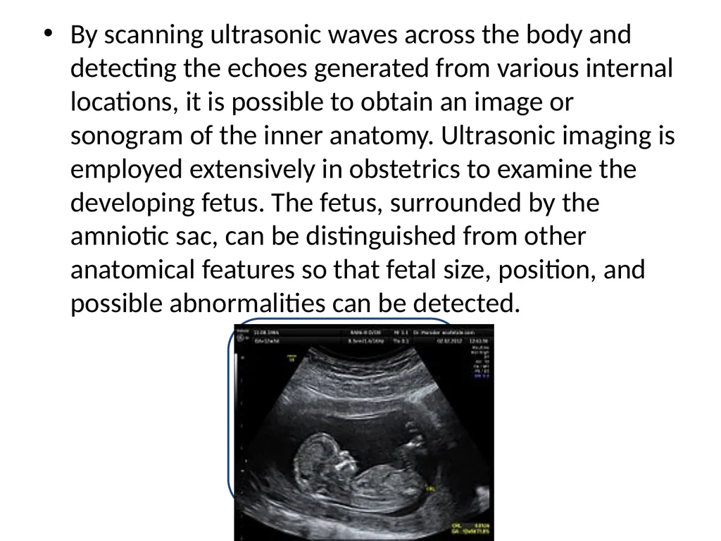 ULTRASOUND IN MEDICINE When ultrasonic waves are - slide 3 of 12