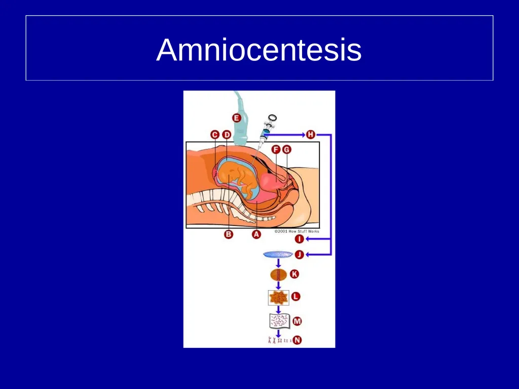 Pre – natal testing what is it and why do - slide 4 of 23