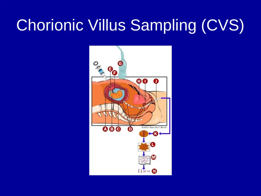 Pre – natal testing what is it and why do - slide 6 of 23