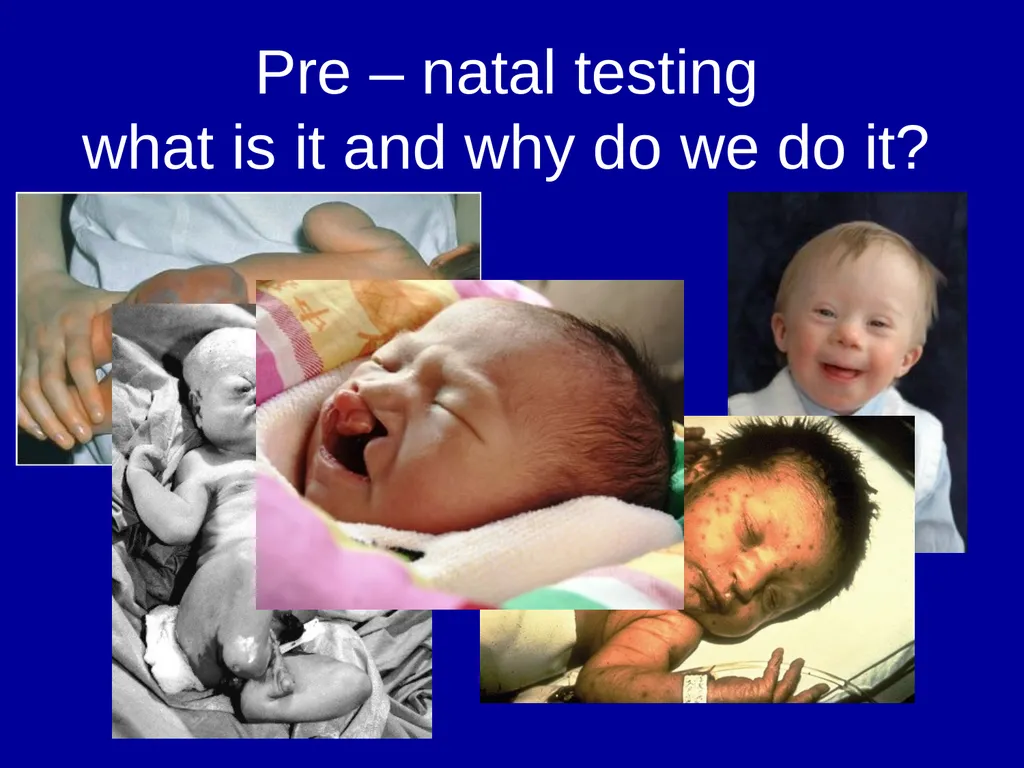 Pre – natal testing what is it and why do - slide 1 of 23